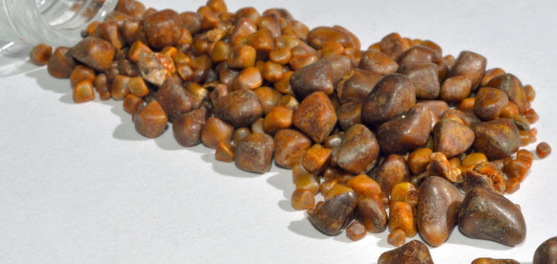 Batu Empedu: Gejala, Penyebab, dan&nbsp;Pengobatan