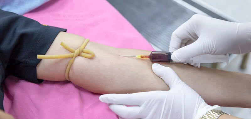 Rubella (Campak Jerman): Gejala, Penyebab, dan Pengobatan