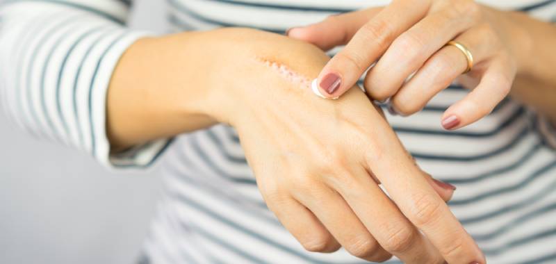 10 Manfaat Vitamin E untuk Kulit Wajah dan Tubuh