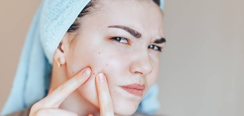 Jerawat: Gejala, Penyebab, dan Pengobatan